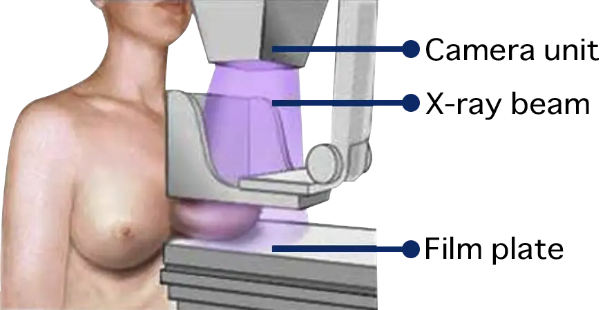 MediScan(株)乳がん呼気スクリーニング検査キット